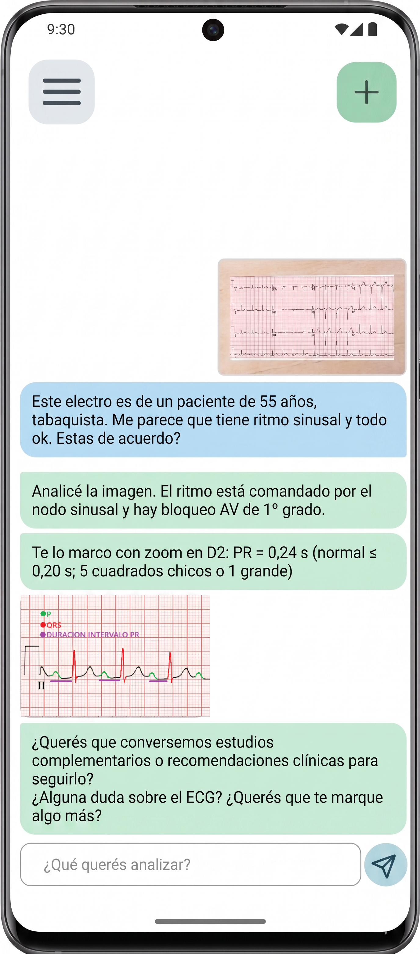 Análisis de ECG con chat en la aplicación SmartECG